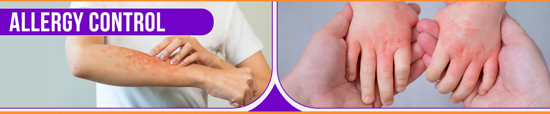 carpet cleaning in Westchester, carpet cleaning in Westchester, carpet cleaning Westchester, carpet cleaners in Westchester, carpet cleaners in Westchester, commercial carpet cleaning, commercial carpet cleaning in Westchester, Westchester rug cleaners, rug cleaning services in Westchester, same day carpet cleaning, same day rug cleaning